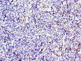 Immunohistochemistry of paraffin-embedded human thymus tissue using CD6 Antibody at dilution of 1:100Rabbit anti-Human CD6 Polyclonal Antibody