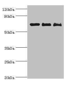 Western blot | All lanes: CD6 antibody at 4μg/ml | Lane 1: Hela whole cell lysate | Lane 2: Jurkat whole cell lysate | Lane 3: HT-29 whole cell lysate | Secondary | Goat polyclonal to rabbit IgG at 1/10000 dilution | Predicted band size: 72, 69, 64, 65, 59, 61 kDa | Observed band size: 72 kDaRabbit anti-Human CD6 Polyclonal Antibody