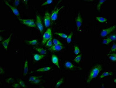 Immunofluorescence staining of Hela cells with AXL Antibody at 1:144, counter-stained with DAPI. The cells were fixed in 4% formaldehyde, permeabilized using 0.2% Triton X-100 and blocked in 10% normal Goat Serum. The cells were then incubated with the antibody overnight at 4°C. The secondary antibody was Alexa Fluor 488-congugated AffiniPure Goat Anti-Rabbit IgG(H+L).
