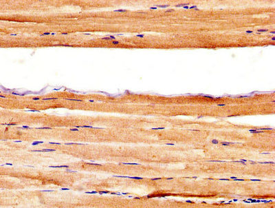 IHC image of the antibody diluted at 1:400 and staining in paraffin-embedded human skeletal muscle tissue performed on a Leica BondTM system. After dewaxing and hydration, antigen retrieval was mediated by high pressure in a citrate buffer (pH 6.0). Section was blocked with 10% normal goat serum 30min at RT. Then primary antibody (1% BSA) was incubated at 4°C overnight. The primary is detected by a biotinylated secondary antibody and visualized using an HRP conjugated SP system.