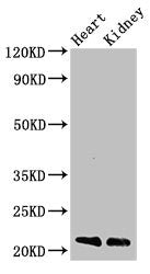 Western Blot | Positive WB detected in: Mouse heart tissue, Mouse kidney tissue | All lanes: SDC4 antibody at 3μg/ml | Secondary | Goat polyclonal to rabbit IgG at 1/50000 dilution | Predicted band size: 22, 17 kDa | Observed band size: 22 kDaRabbit anti-Human SDC4 Polyclonal Antibody
