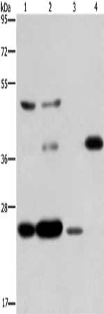 Gel: 8%SDS-PAGE, Lysate: 40 μg, Lane 1-4: LoVo cells, Raji cells, HepG2 cells, mouse skeletal muscle tissue, Primary antibody: CFLAR Antibody(CFLAR Antibody) at dilution 1/200, Secondary antibody: Goat anti rabbit IgG at 1/8000 dilution, Exposure time: 1 minuteRabbit anti-Human CFLAR Polyclonal Antibody