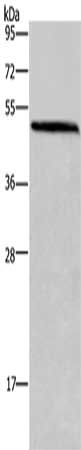 Gel: 10%SDS-PAGE, Lysate: 40 μg, Lane: Mouse brain tissue, Primary antibody: HOMER1 Antibody(HOMER1 Antibody) at dilution 1/400, Secondary antibody: Goat anti rabbit IgG at 1/8000 dilution, Exposure time: 10 secondsRabbit anti-Human HOMER1 Polyclonal Antibody
