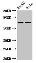 Western Blot  | Positive WB detected in: HepG2 whole cell lysate, Hela whole cell lysate  | All lanes: AMFR antibody at 4µg/ml  | Secondary  | Goat polyclonal to rabbit IgG at 1/50000 dilution  | Predicted band size: 73 kDa  | Observed band size: 73 kDaRabbit anti-Human AMFR Polyclonal Antibody