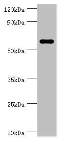 Western blot | All lanes: CSTF2 antibody at 6μg/ml + Jurkat whole cell lysate | Secondary | Goat polyclonal to rabbit IgG at 1/10000 dilution | Predicted band size: 61, 60 kDa | Observed band size: 61 kDaRabbit anti-Human CSTF2 Polyclonal Antibody