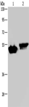 Gel: 8%SDS-PAGE, Lysate: 40 μg, Lane 1-2: Raji cells, Hela cells, Primary antibody: AVEN Antibody(AVEN Antibody) at dilution 1/200, Secondary antibody: Goat anti rabbit IgG at 1/8000 dilution, Exposure time: 2 minutesRabbit anti-Human AVEN Polyclonal Antibody