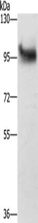 Gel: 6%SDS-PAGE, Lysate: 40 μg, Lane: Hela cells, Primary antibody: DAB2 Antibody(DAB2 Antibody) at dilution 1/300, Secondary antibody: Goat anti rabbit IgG at 1/8000 dilution, Exposure time: 1 secondRabbit anti-Human DAB2 Polyclonal Antibody