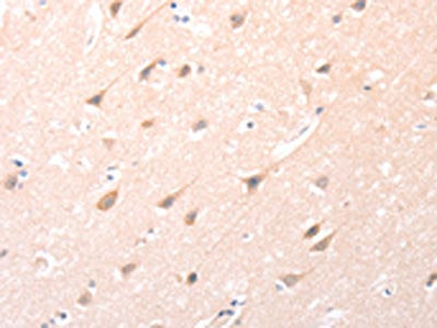 The image on the left is immunohistochemistry of paraffin-embedded Human brain  tissue using ANGPTL2 Antibody(ANGPTL2 Antibody) at dilution 1/20, on the right is treated with synthetic peptide. (Original magnification: ×200)Rabbit anti-Human ANGPTL2 Polyclonal Antibody