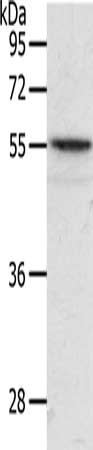 Gel: 10%SDS-PAGE, Lysate: 40 μg, Lane: Mouse intestinum tenue tissue, Primary antibody: ANGPTL2 Antibody(ANGPTL2 Antibody) at dilution 1/400, Secondary antibody: Goat anti rabbit IgG at 1/8000 dilution, Exposure time: 20 secondsRabbit anti-Human ANGPTL2 Polyclonal Antibody