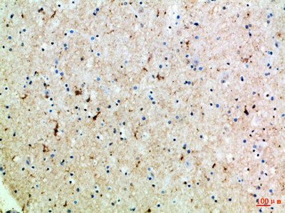 Immunohistochemical analysis of paraffin-embedded Human-brain, antibody was diluted at 1:100