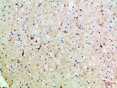 Immunohistochemical analysis of paraffin-embedded Human-brain, antibody was diluted at 1:100