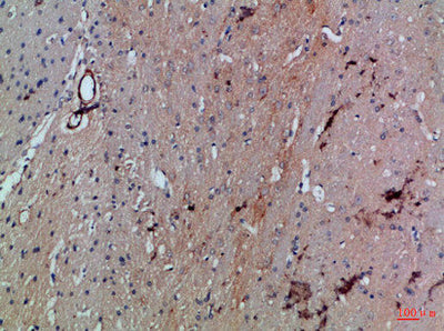 Immunohistochemical analysis of paraffin-embedded Rat-brain, antibody was diluted at 1:100