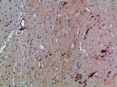 Immunohistochemical analysis of paraffin-embedded Rat-brain, antibody was diluted at 1:100