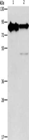 Gel: 8%SDS-PAGE, Lysate: 40 μg, Lane 1-2: Mouse brain tissue, human brain malignant glioma tissue, Primary antibody: KIF3A Antibody(KIF3A Antibody) at dilution 1/750, Secondary antibody: Goat anti rabbit IgG at 1/8000 dilution, Exposure time: 30 seconds
