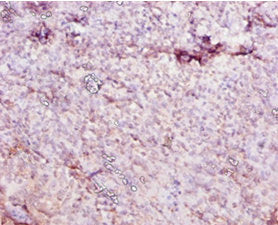 Immunohistochemistry of paraffin-embedded human tonsil tissue using Ces1c Antibody at dilution of 1:10Rabbit anti-Mouse Ces1c Polyclonal Antibody