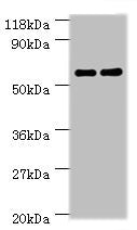 Western blot | All lanes: Ces1c antibody at 2μg/ml | Lane 1: Mouse liver tissue | Lane 2: Rat liver tissue | Secondary | Goat polyclonal to rabbit IgG at 1/10000 dilution | Predicted band size: 62 kDa | Observed band size: 62 kDaRabbit anti-Mouse Ces1c Polyclonal Antibody