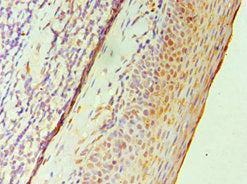 Immunohistochemistry of paraffin-embedded human tonsil tissue using GATA2 Antibody at dilution of 1:100Rabbit anti-Human GATA2 Polyclonal Antibody