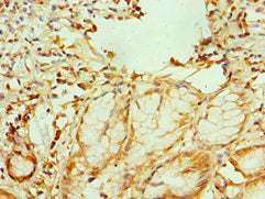 Immunohistochemistry of paraffin-embedded human gallbladder tissue using GATA2 Antibody at dilution of 1:100Rabbit anti-Human GATA2 Polyclonal Antibody