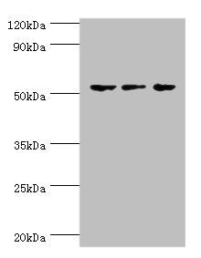 Western blot | All lanes: Endothelial transcription factor GATA-2 antibody at 3μg/ml | Lane 1: Hela whole cell lysate | Lane 2: K562 whole cell lysate | Lane 3: Mouse heart tissue | Secondary | Goat polyclonal to rabbit IgG at 1/10000 dilution | Predicted band size: 51, 50 kDa | Observed band size: 51 kDaRabbit anti-Human GATA2 Polyclonal Antibody