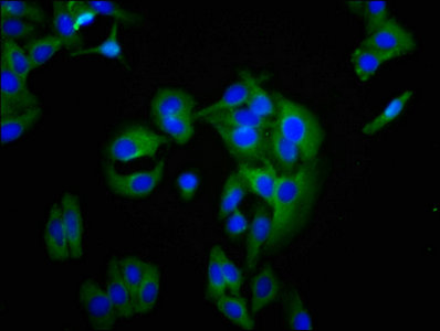 Immunofluorescence staining of HepG2 cells with BCAM Antibody at 1:200, counter-stained with DAPI. The cells were fixed in 4% formaldehyde, permeabilized using 0.2% Triton X-100 and blocked in 10% normal Goat Serum. The cells were then incubated with the antibody overnight at 4°C. The secondary antibody was Alexa Fluor 488-congugated AffiniPure Goat Anti-Rabbit IgG(H+L).
