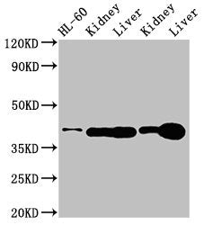 Western Blot | Positive WB detected in: HL60 whole cell lysate, Rat kidney tissue, Rat liver tissue, Mouse kideny tissue, Mouse liver tissue | All lanes: ADK antibody at 3μg/ml | Secondary | Goat polyclonal to rabbit IgG at 1/50000 dilution | Predicted band size: 41, 39, 35, 37 kDa | Observed band size: 41 kDa