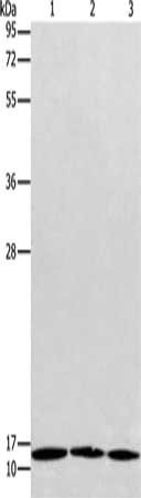 Gel: 12%SDS-PAGE, Lysate: 40 μg, Lane 1-3: Jurkat cells, K562 cells, Raji cells, Primary antibody: RPS27 Antibody(RPS27 Antibody) at dilution 1/300, Secondary antibody: Goat anti rabbit IgG at 1/8000 dilution, Exposure time: 10 secondsRabbit anti-Human RPS27 Polyclonal Antibody