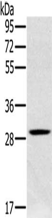 Gel: 10%SDS-PAGE, Lysate: 40 μg, Lane: Human testis tissue, Primary antibody: CLIC1 Antibody(CLIC1 Antibody) at dilution 1/400, Secondary antibody: Goat anti rabbit IgG at 1/8000 dilution, Exposure time: 1 minuteRabbit anti-Human CLIC1 Polyclonal Antibody