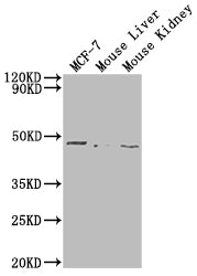 Western Blot | Positive WB detected in: MCF-7 whole cell lysate, Mouse Liver tissue, Mouse Kidney tissue | All lanes: NRXN1 antibody at 1:2000 | Secondary | Goat polyclonal to rabbit IgG at 1/50000 dilution | Predicted band size: 47 kDa | Observed band size: 47 kDaRabbit anti-Human NRXN1 Polyclonal Antibody