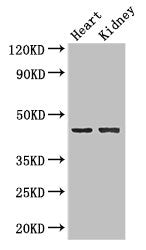 Western Blot | Positive WB detected in: Mouse heart tissue, Mouse kidney tissue | All lanes: NRXN1 antibody at 2μg/ml | Secondary | Goat polyclonal to rabbit IgG at 1/50000 dilution | Predicted band size: 47, 51, 162, 165, 170, 16 kDa | Observed band size: 47 kDaRabbit anti-Human NRXN1 Polyclonal Antibody