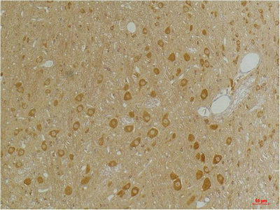 Immunohistochemical analysis of paraffin-embedded Rat BrainTissue using GABA A Receptor α3 Rabbit pAb diluted at 1:200.Rabbit anti-Human GABRA3 Polyclonal Antibody