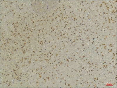 Immunohistochemical analysis of paraffin-embedded Mouse BrainTissue using GABA A Receptor α3 Rabbit pAb diluted at 1:200.Rabbit anti-Human GABRA3 Polyclonal Antibody