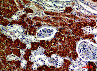 Immunohistochemical analysis of paraffin-embedded human-kidney, antibody was diluted at 1:200Rabbit anti-Human DROSHA Polyclonal Antibody