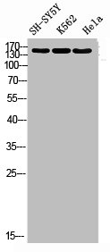 Western blot analysis of SH-SY5Y K562 HELA using RNase III Drosha antibody. Antibody was diluted at 1:1000. Secondary antibody  was diluted at 1:20000Rabbit anti-Human DROSHA Polyclonal Antibody
