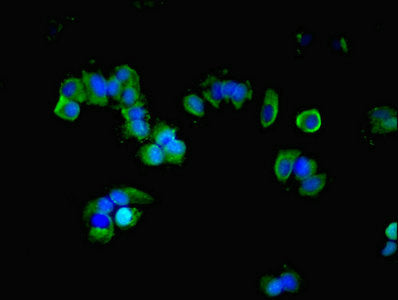 Immunofluorescent analysis of MCF-7 cells using GNAS Antibody at dilution of 1:100 and Alexa Fluor 488-congugated AffiniPure Goat Anti-Rabbit IgG(H+L)Rabbit anti-Human GNAS Polyclonal Antibody