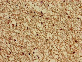 Immunohistochemistry of paraffin-embedded human brain tissue using GNAS Antibody at dilution of 1:100Rabbit anti-Human GNAS Polyclonal Antibody