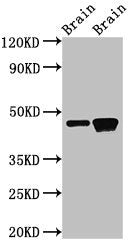 Western Blot  | Positive WB detected in: Rat brain tissue, Mouse brain tissue  | All lanes: GNAS antibody at 3µg/ml  | Secondary  | Goat polyclonal to rabbit IgG at 1/50000 dilution  | Predicted band size: 46, 45, 112, 110, 78, 29 kDa  | Observed band size: 46 kDaRabbit anti-Human GNAS Polyclonal Antibody