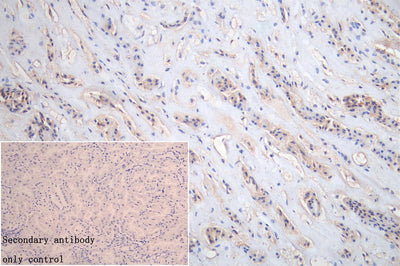Immunohistochemistry of paraffin-embedded human kidney tissue using ERVFRD-1 Antibody at dilution of 1:100Rabbit anti-Human ERVFRD-1 Polyclonal Antibody