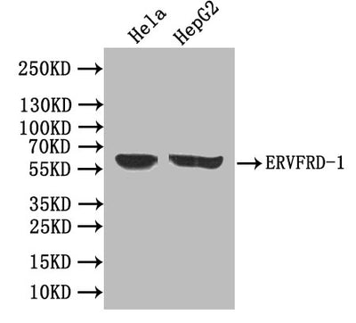 Western blot | All lanes: ERVFRD-1 antibody at 3.93μg/ml | Lane 1: Hela whole cell lysate | Lane 2: HepG2 whole cell lysate | Lane 3: A431 whole cell lysate | Secondary | Goat polyclonal to rabbit IgG at 1/10000 dilution | Predicted band size: 60 kDa | Observed band size: 60 kDaRabbit anti-Human ERVFRD-1 Polyclonal Antibody