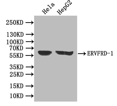 Western blot | All lanes: ERVFRD-1 antibody at 3.93μg/ml | Lane 1: Hela whole cell lysate | Lane 2: HepG2 whole cell lysate | Lane 3: A431 whole cell lysate | Secondary | Goat polyclonal to rabbit IgG at 1/10000 dilution | Predicted band size: 60 kDa | Observed band size: 60 kDaRabbit anti-Human ERVFRD-1 Polyclonal Antibody