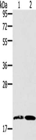 Gel: 8%SDS-PAGE, Lysate: 40 μg, Lane 1-2: Mouse heart tissue, Mouse liver tissue, Primary antibody: GDF2 Antibody(GDF2 Antibody) at dilution 1/200, Secondary antibody: Goat anti rabbit IgG at 1/8000 dilution, Exposure time: 40 secondsRabbit anti-Human GDF2 Polyclonal Antibody