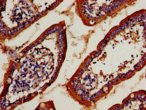 Immunocytochemistry analysis of human small intestine tissue using TRBV7-9 Antibody at dilution of 1:100Rabbit anti-Human TCRB Polyclonal Antibody
