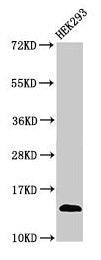 Western Blot  | Positive WB detected in: HEK293 whole cell lysate  | All lanes: TRBV7-9 antibody at 3µg/ml  | Secondary  | Goat polyclonal to rabbit IgG at 1/50000 dilution  | Predicted band size: 14 kDa  | Observed band size: 14 kDaRabbit anti-Human TCRB Polyclonal Antibody