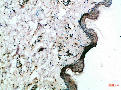Immunohistochemical analysis of paraffin-embedded Human-skin, antibody was diluted at 1:100Rabbit anti-Human FZD4 Polyclonal Antibody