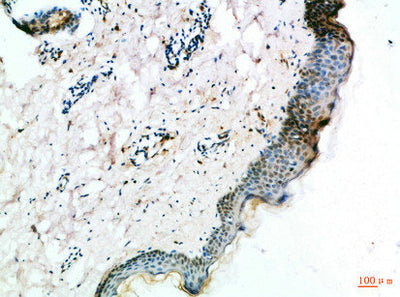 Immunohistochemical analysis of paraffin-embedded Human-skin, antibody was diluted at 1:100Rabbit anti-Human FZD4 Polyclonal Antibody