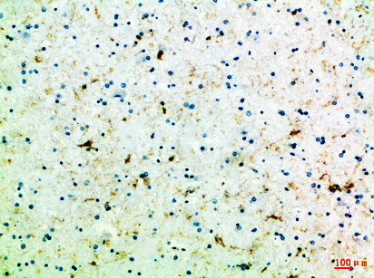 Immunohistochemical analysis of paraffin-embedded Human-brain, antibody was diluted at 1:100Rabbit anti-Human FZD4 Polyclonal Antibody
