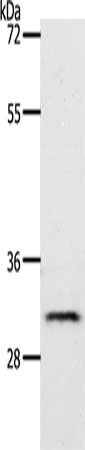 Gel: 10%SDS-PAGE, Lysate: 40 μg, Lane: Mouse lung tissue, Primary antibody: TPM2 Antibody(TPM2 Antibody) at dilution 1/450, Secondary antibody: Goat anti rabbit IgG at 1/8000 dilution, Exposure time: 2 minutesRabbit anti-Human TPM2 Polyclonal Antibody