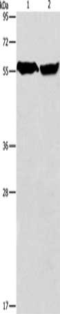 Gel: 8%SDS-PAGE, Lysate: 40 μg, Lane 1-2: Mouse heart tissue, human fetal brain tissue, Primary antibody: ARHGEF9 Antibody(ARHGEF9 Antibody) at dilution 1/950, Secondary antibody: Goat anti rabbit IgG at 1/8000 dilution, Exposure time: 5 secondsRabbit anti-Human ARHGEF9 Polyclonal Antibody