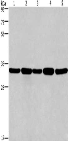 Gel: 8%SDS-PAGE, Lysate: 40 μg, Lane 1-5: LoVo cells, A549 cells, human hepatocellular carcinoma tissue, Jurkat cells, Hela cells, Primary antibody: E2F6 Antibody(E2F6 Antibody) at dilution 1/650, Secondary antibody: Goat anti rabbit IgG at 1/8000 dilution, Exposure time: 30 secondsRabbit anti-Human E2F6 Polyclonal Antibody