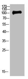 Western Blot analysis of 3T3 cells using Antibody diluted at 500. Secondary antibody  was diluted at 1:20000Rabbit anti-Human CTNND1 Polyclonal Antibody