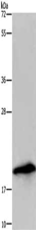 Gel: 10%SDS-PAGE, Lysate: 40 μg, Lane: U937 cells, Primary antibody: RNASE3 Antibody(RNASE3 Antibody) at dilution 1/200, Secondary antibody: Goat anti rabbit IgG at 1/8000 dilution, Exposure time: 3 minutesRabbit anti-Human RNASE3 Polyclonal Antibody